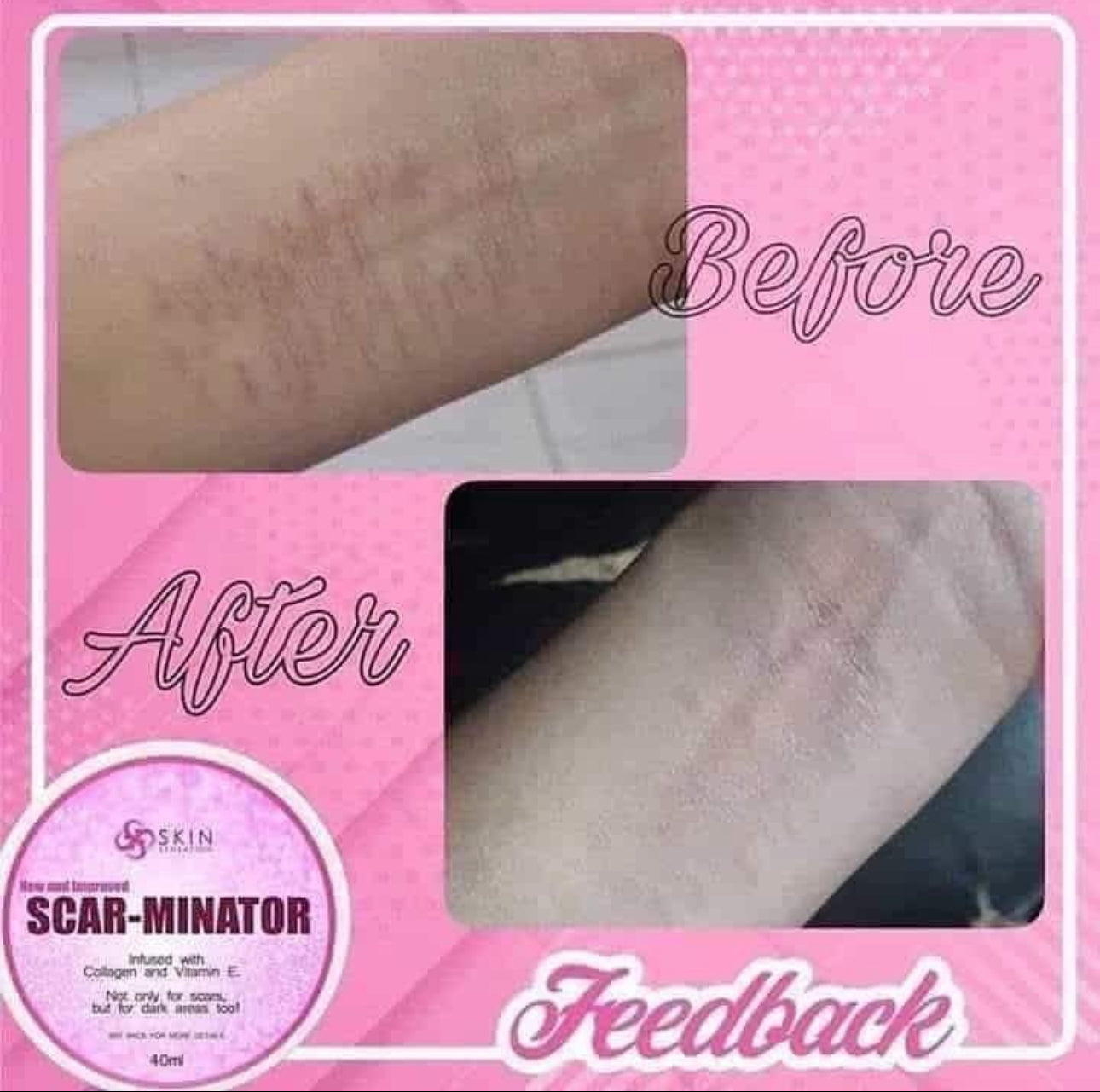 Scarminator Cream by Skin Sensation 40ml