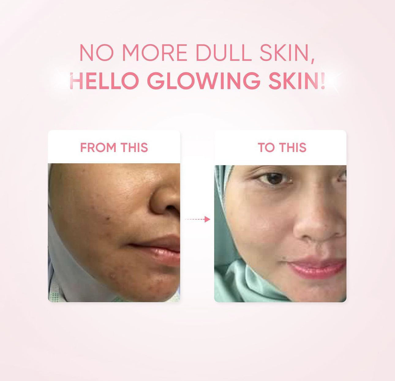 SKINTIFIC MSH Niacinamide Brightening Moisture Gel 30g