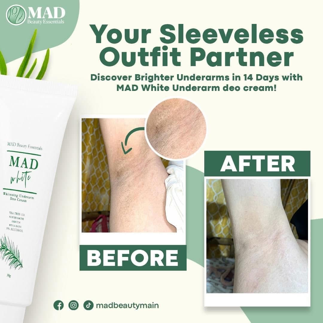 MAD White Whitening Underarm Deo Cream 30g