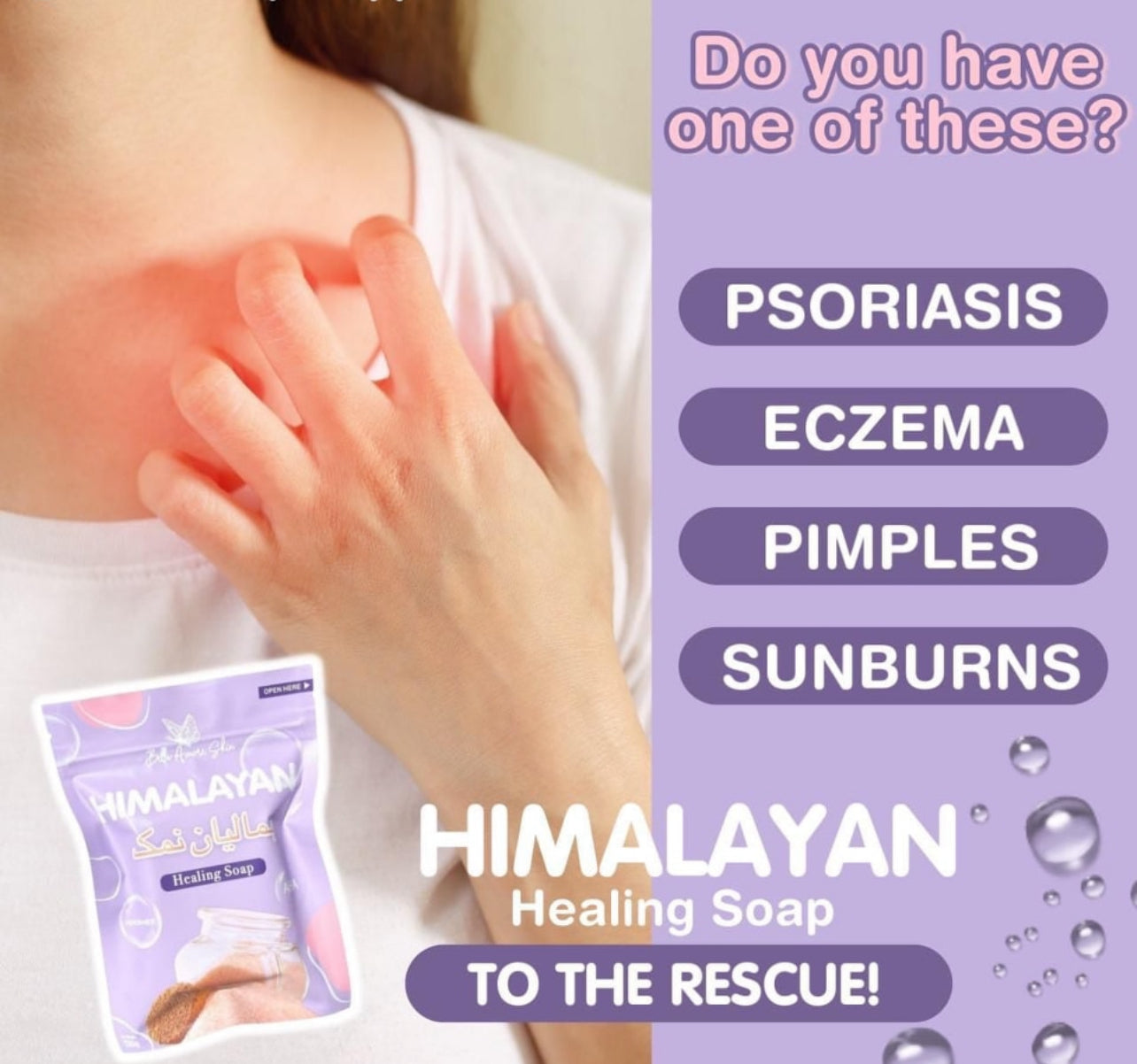 Bella Amore Skin Himalayan Healing/Brightening Soap 135g