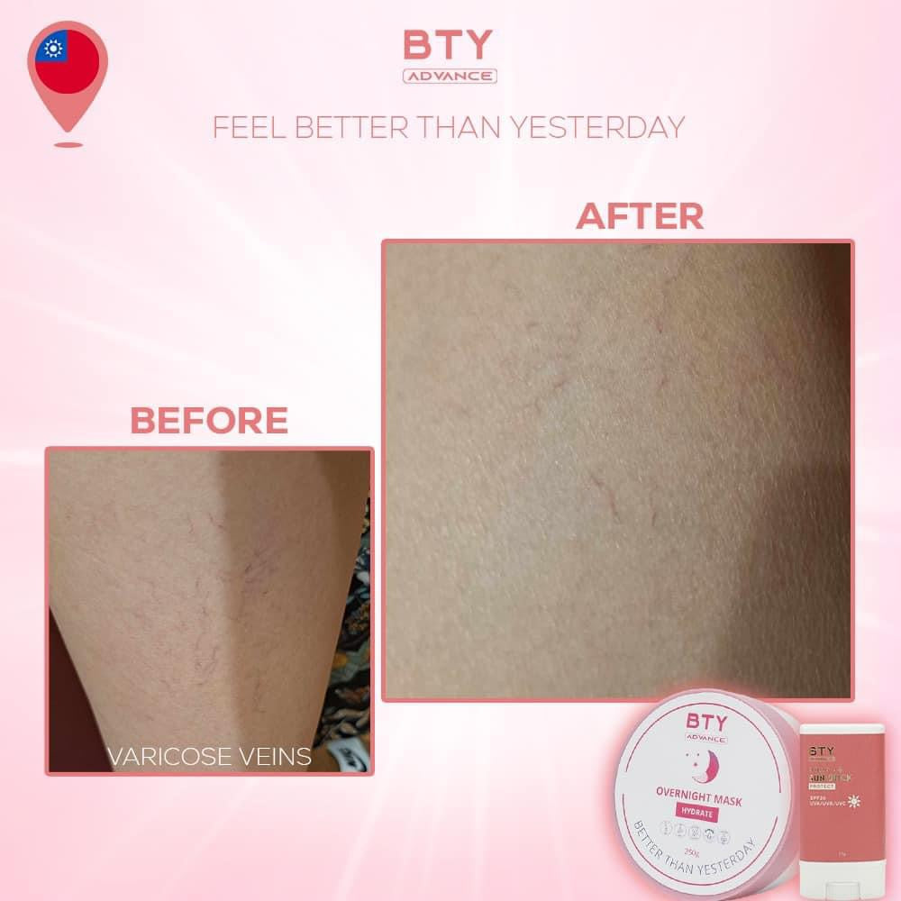 BTY Advance Basic Skincare Set