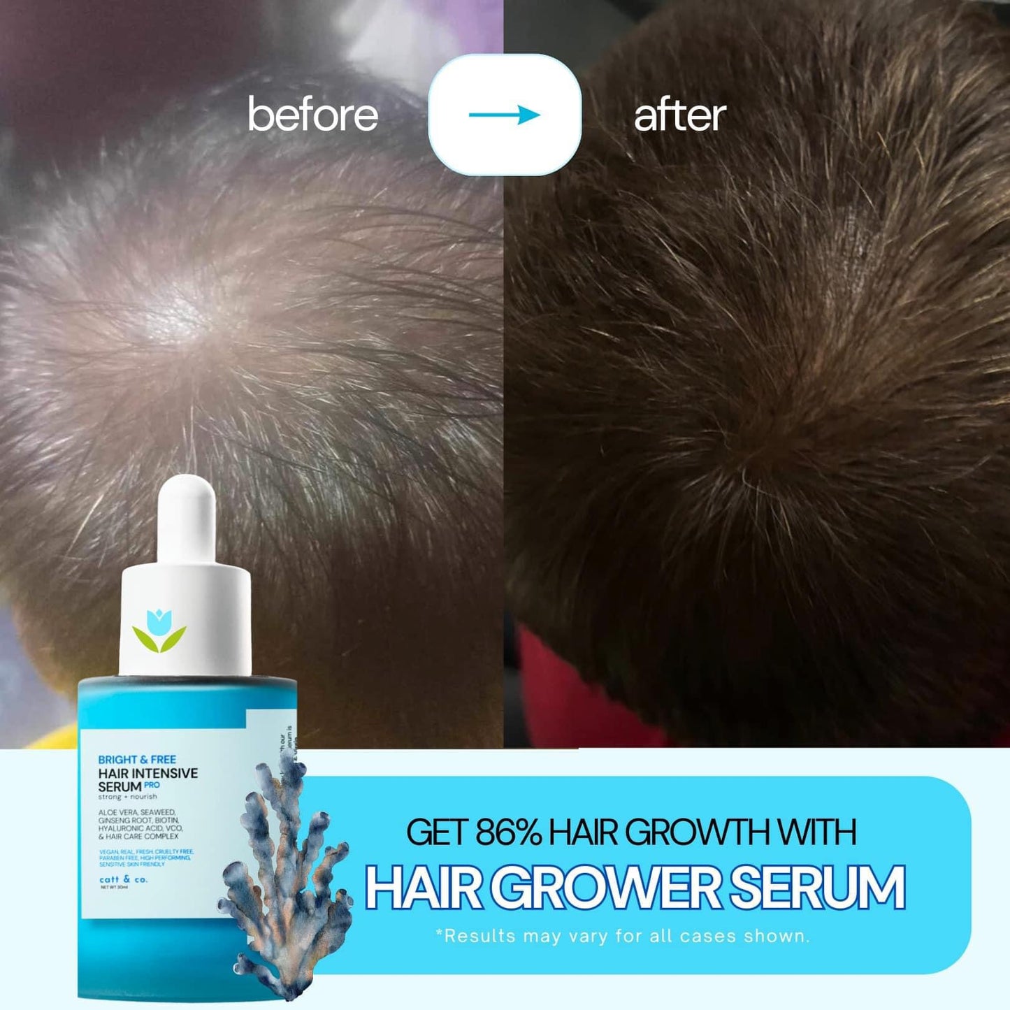 Bright & Free Hair Intensive Serum Pro (Strong + Nourish) 30ml