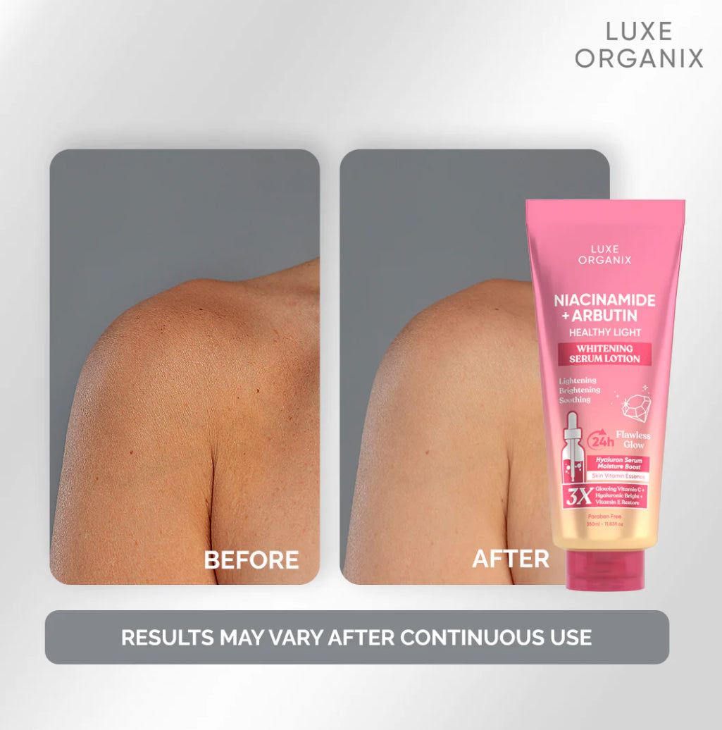 Luxe Organix Niacinamide + Arbutin Healthy Light Whitening Serum Lotion (350ml)