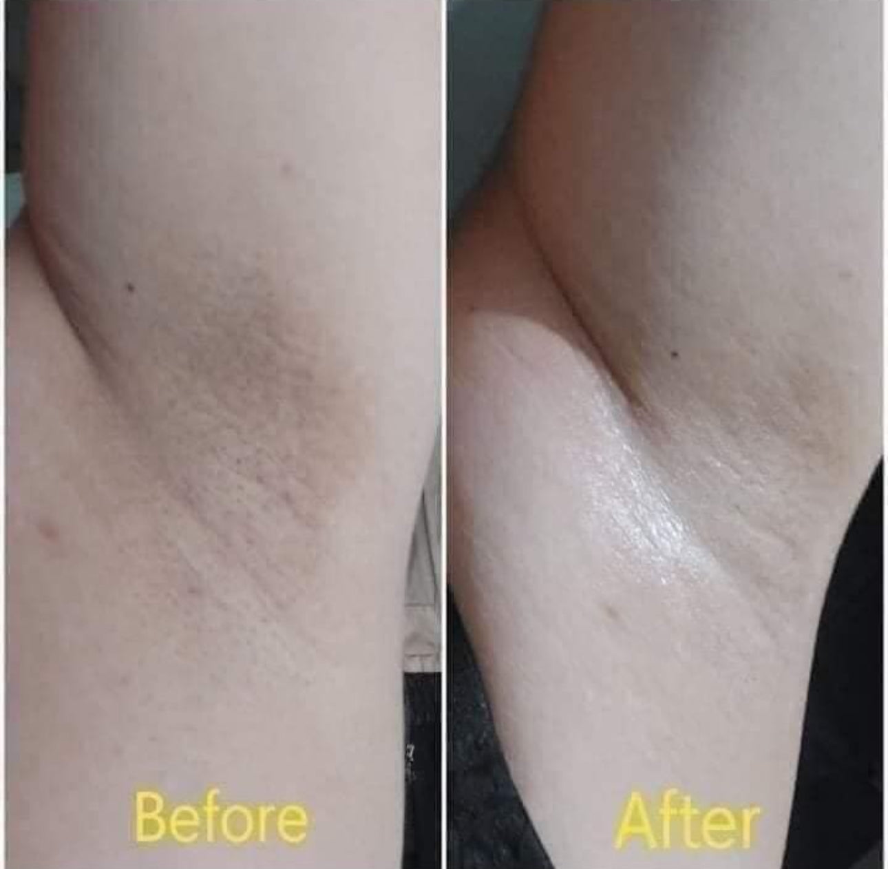 88 Total White Underarm Cream 35g