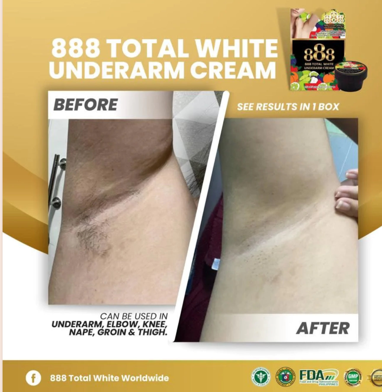888 Total White Underarm Cream 35g
