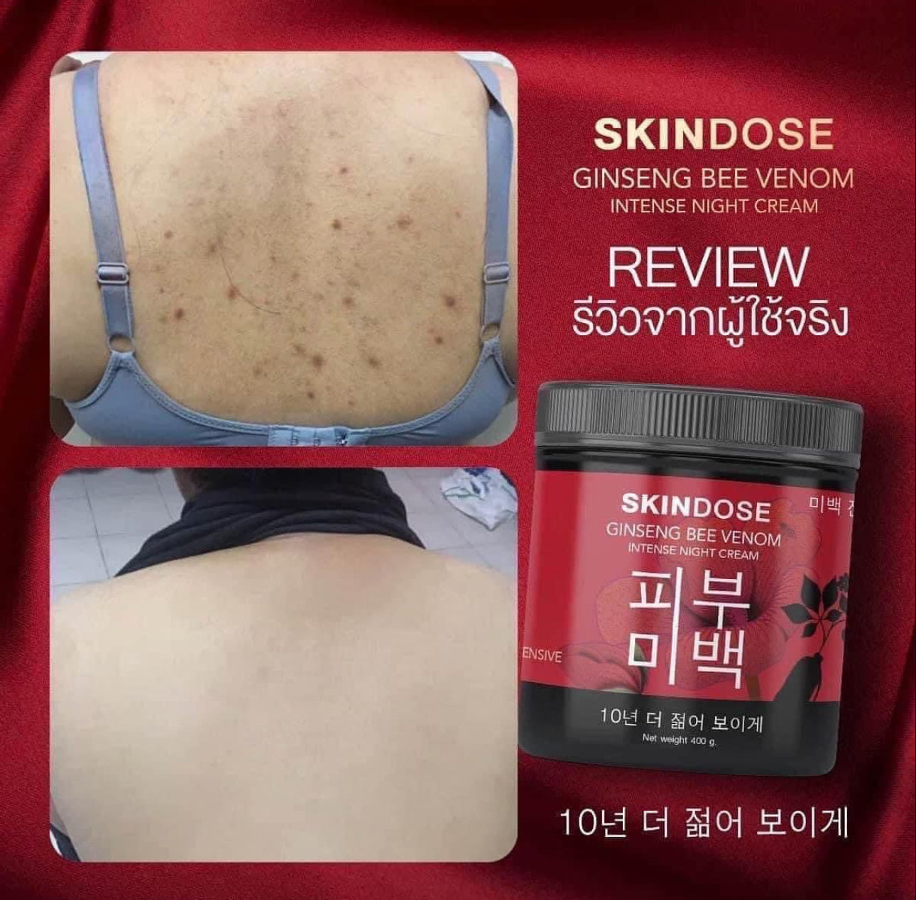 Skindose Ginseng Bee Venom Intense Night Cream 400g