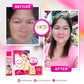SCD Peeling Set