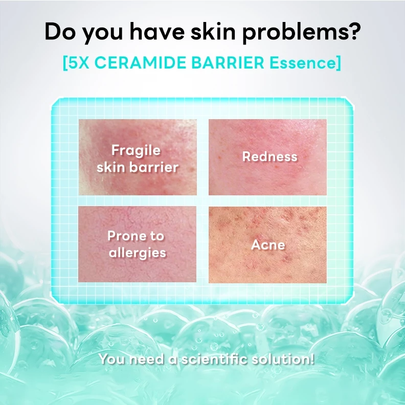 PAPA FEEL 5X Ceramide Skin Barrier Repair Serum 20ml