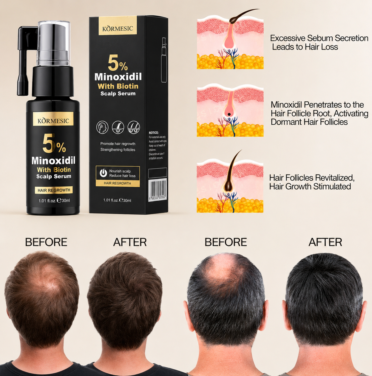 Kormesic 5% Minoxidil with Biotin Scalp Serum 30ml