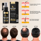Kormesic 5% Minoxidil with Biotin Scalp Serum 30ml