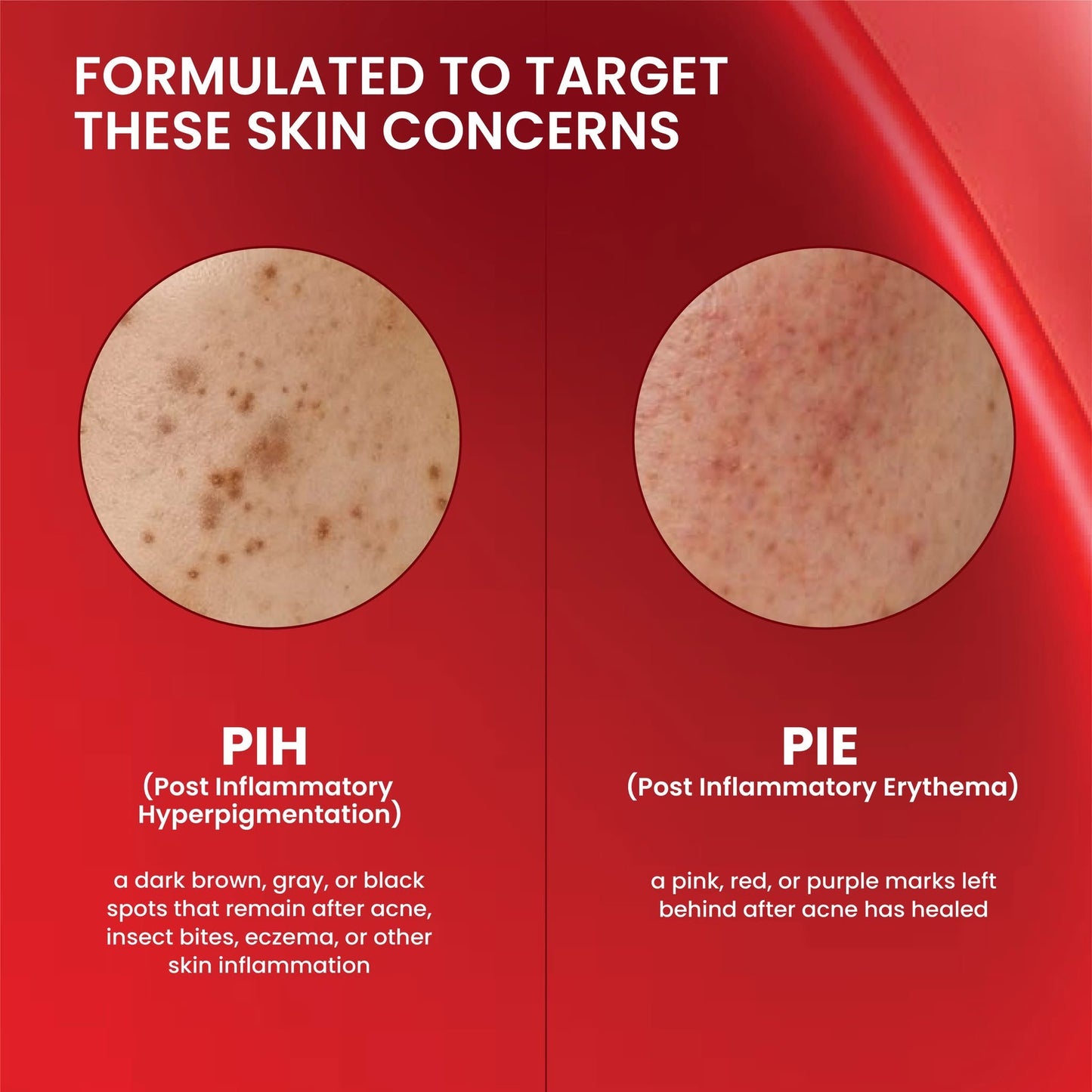 Luxe Organix DermaPRO Complexion Perfecting Renewing Glow Peel Deep Resurface Serum 30ml