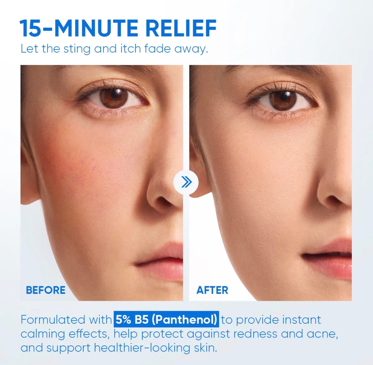SKINTIFIC 5% B5 Ceramide Barrier Relief Moisturizer 50g