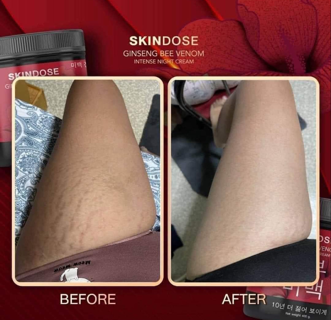 Skindose Ginseng Bee Venom Intense Night Cream 400g