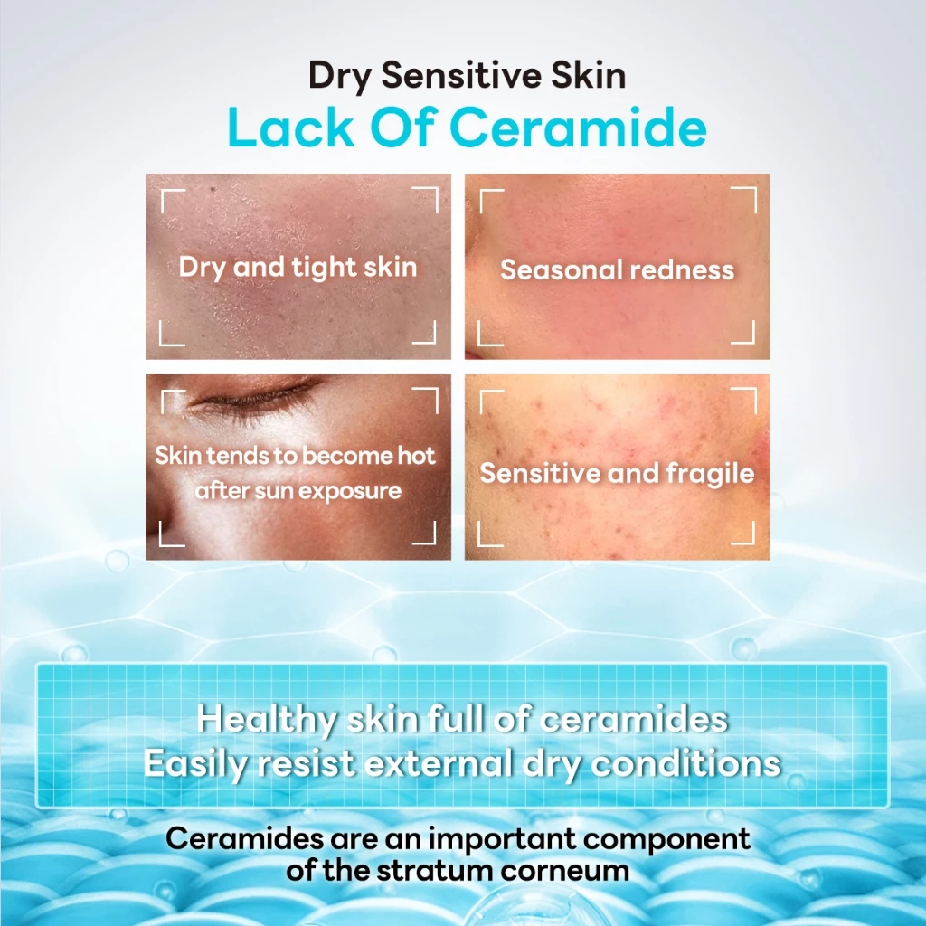 PAPA FEEL 5X Ceramide Repair Barrier Moisturizer 30g