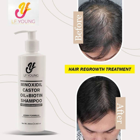 Minoxidil Hair Grower Shampoo with Biotin and Castor Oil for Hair Loss Treatment by LF Young 250ml