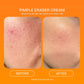 QUICKFX Pimple Eraser 30g