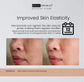 Dermorepubliq Niacinamide Acne And Oil Control Face Bar Soap 135g
