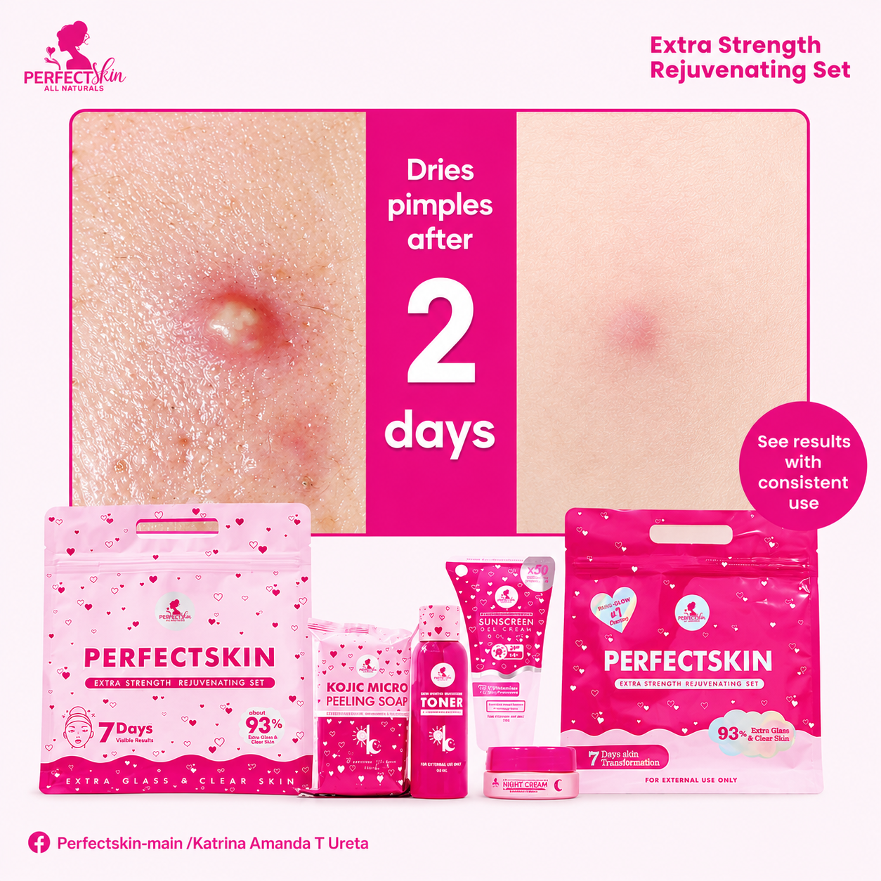 Perfect Skin Extra Strength Rejuvenating Kit