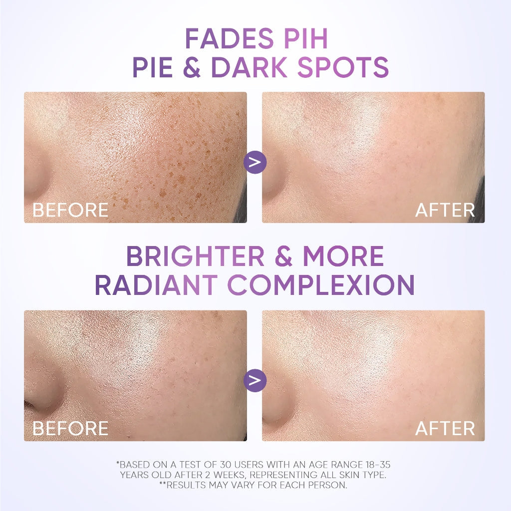 SKINTIFIC Symwhite 377 Dark Spot Moisture Gel 30g