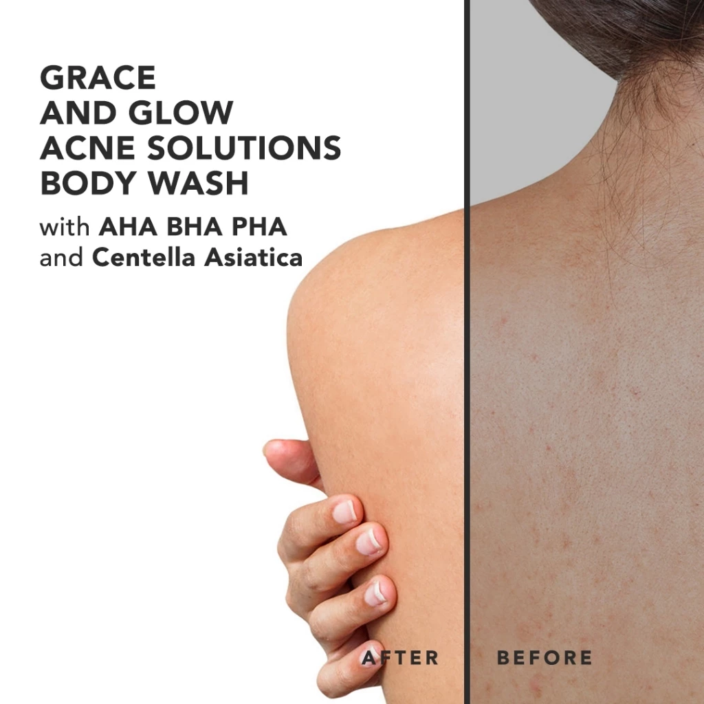 Grace and Glow English Pear And Freesia Anti Acne Solution Body Wash (AHA BHA PHA and Centella Asiatica) 400ml