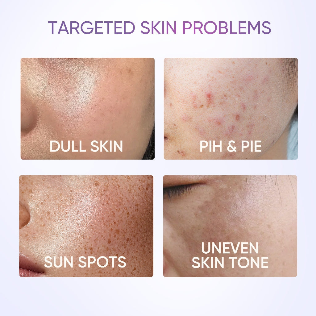 SKINTIFIC Symwhite 377 Dark Spot Moisture Gel 30g