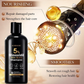 Kormesic Minoxidil 5% Biotin Hair Growth Shampoo (300ml) & Conditioner (300ml)